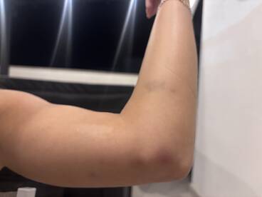 An unclear close-up image of an arm, lacking context or identifiable features.